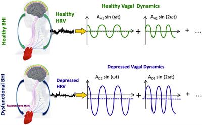 Depression as a cardiovascular disorder: central-autonomic network, brain-heart axis, and vagal perspectives of low mood